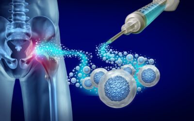 PRP Therapy Near Me vs Stem Cells vs Exosomes: How to Choose the Right Prolotherapy in Upland, CA